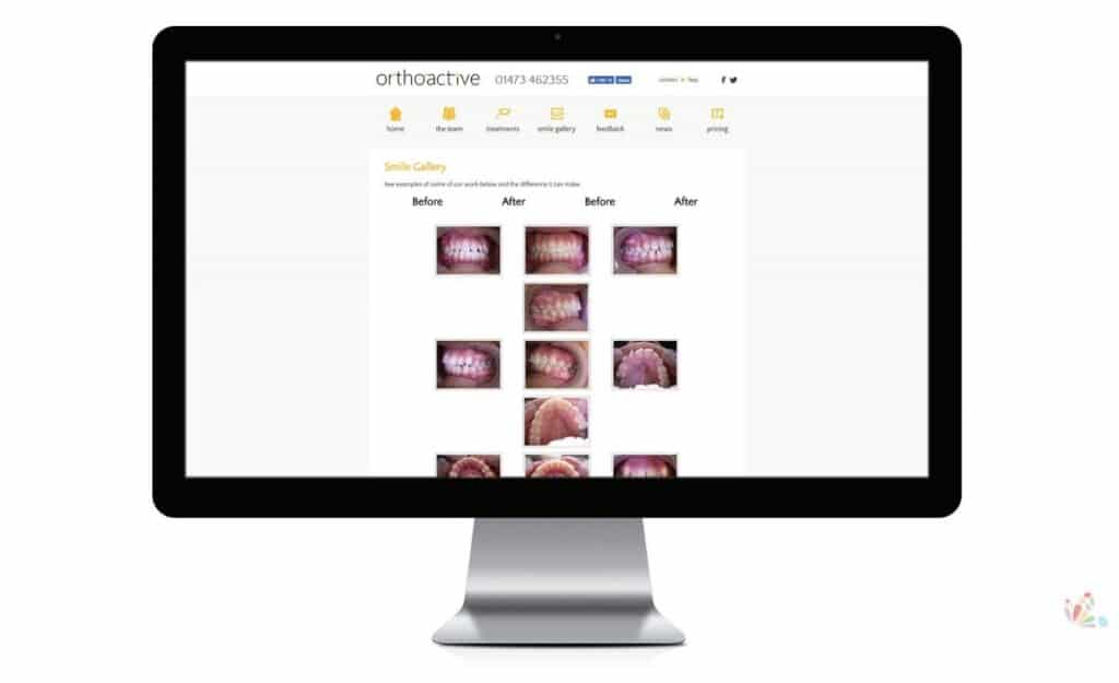 Orthoactive Smile Gallery Mac