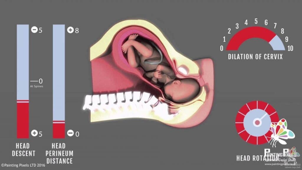 ultrasound animation