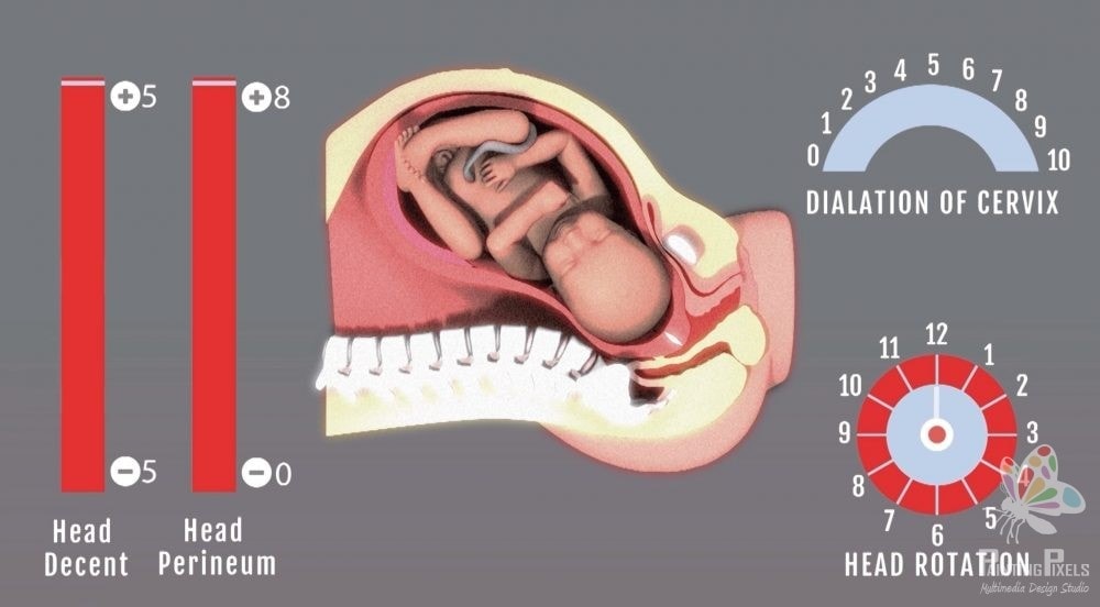 3d animation medical explainer process demonstration ipswich london suffolk essex colchester